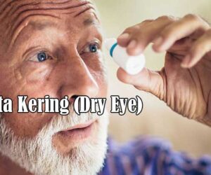 mata kering